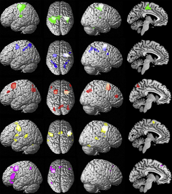 The heterogeneity of the left dorsal premotor cortex evidenced by ...